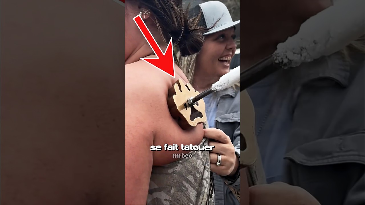 La nouvelle mode des tatouages par marquage &agrave; froid. 🥶