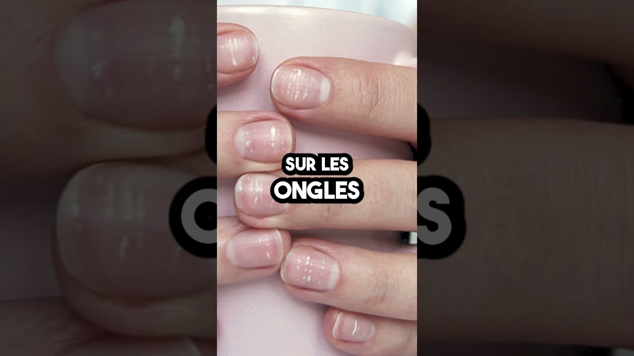 7 CHOSES QUE TES ONGLES TE R&Eacute;V&Egrave;LENT